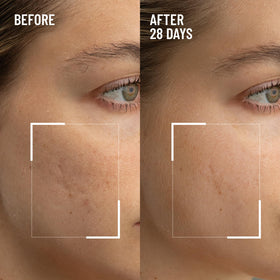 Dr. Brandt open jar showing creamy exfoliant texture and spreadability benefit