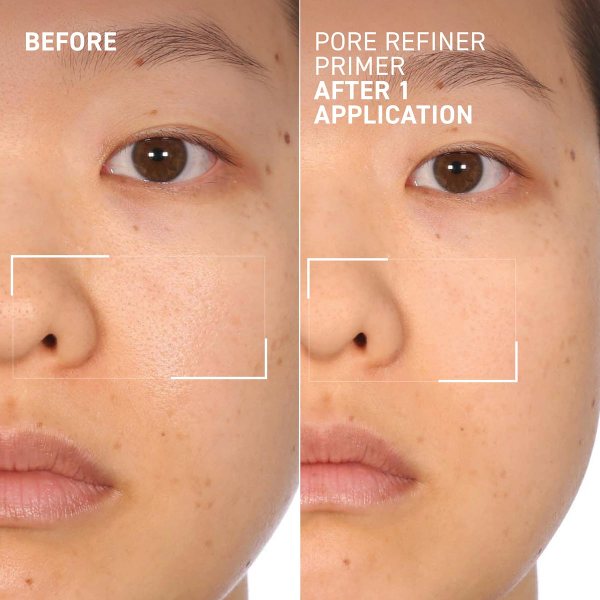 Dr. Brandt side-by-side before and after showing visible pore reduction