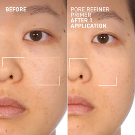 Dr. Brandt side-by-side before and after showing visible pore reduction