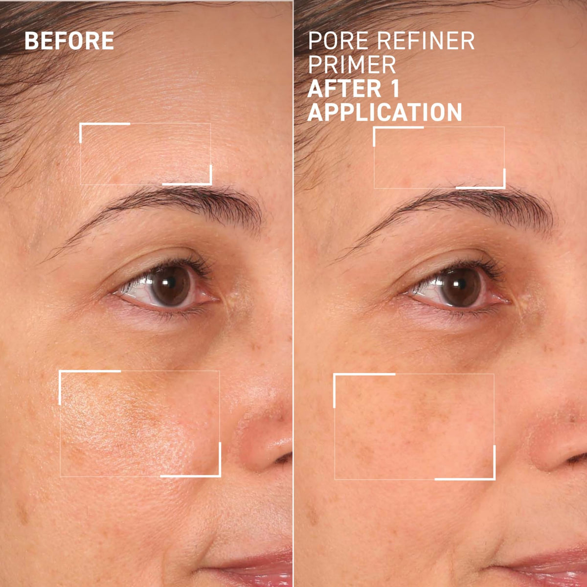 Dr. Brandt product label and ingredient callout highlighting salicylic acid and plant extract
