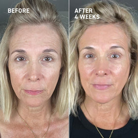 Dr. Brandt gel pumped onto hand highlighting silky texture and easy absorption