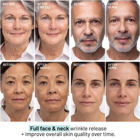 Dr. Brandt serum texture close-up highlighting lightweight formula for fast absorption
