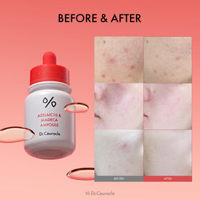leegeehaam Dr.Ceuracle dropper dispensing serum illustrating precise targeted application