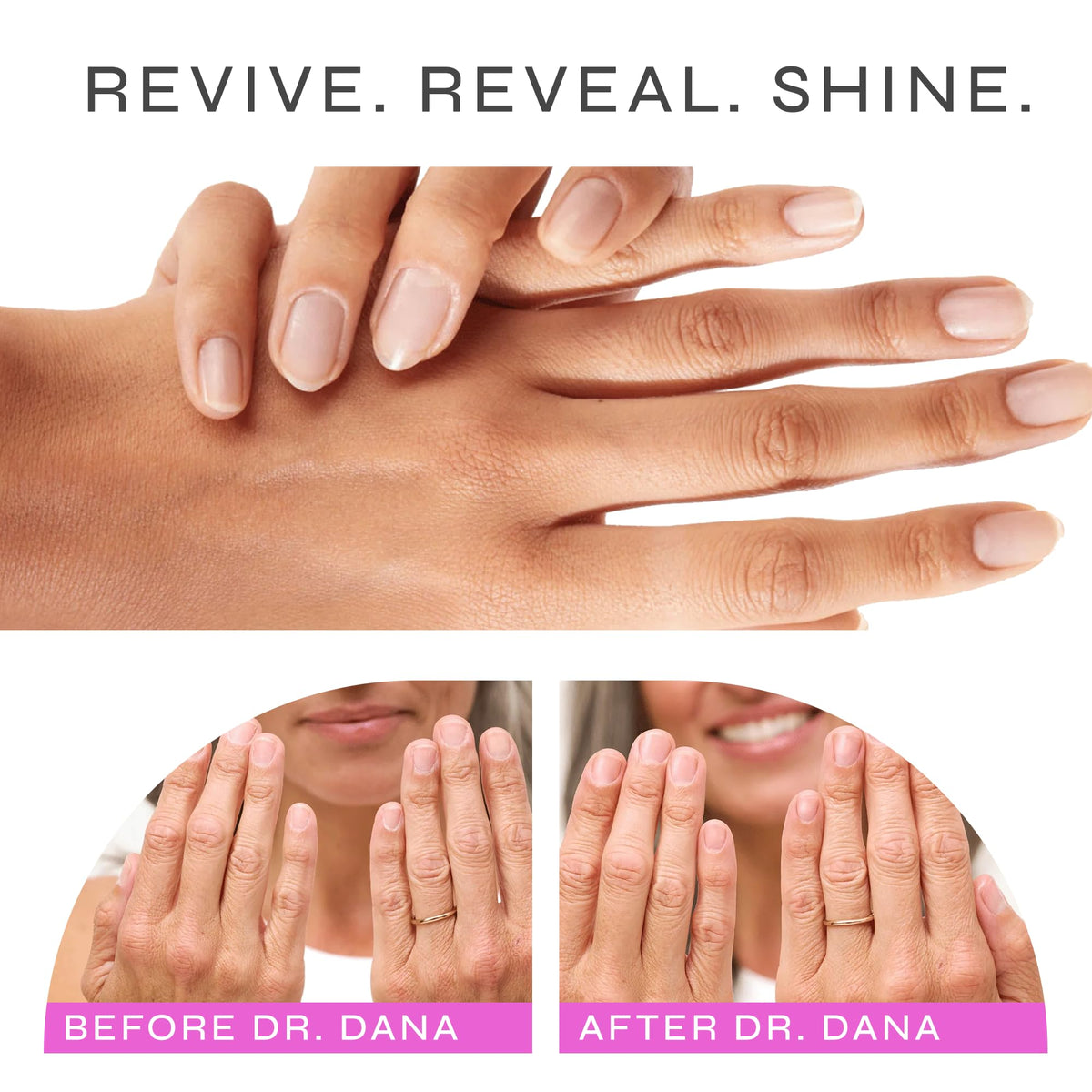Dr. Dana hydrator drop on nail plate to restore moisture