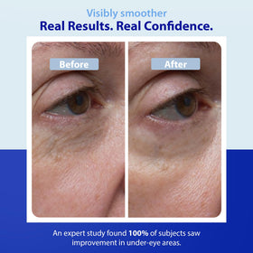 Dr. Denese product being tapped under eye demonstrating lightweight absorption and de-puffing benefit