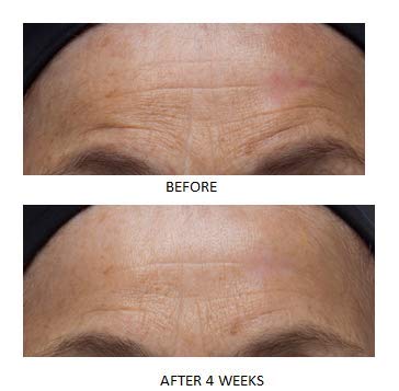 Dr. Denese product placed on bathroom counter showing everyday routine use