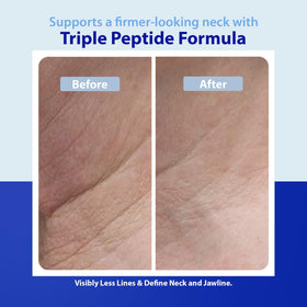 Dr. Denese model applying cream to neck illustrating lifting routine