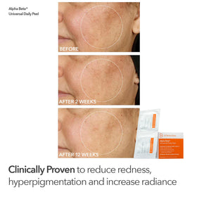 Dr Dennis Gross Alpha Beta peel pads closeup shows textured pads for effective exfoliation benefit: consistent results