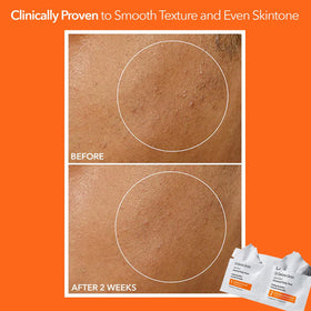 Dr. Dennis Gross Step 2 pad close-up showing soothing formula to calm skin post-peel