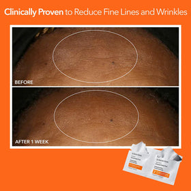 Dr. Dennis Gross treatment in use on model's face demonstrating gentle exfoliation benefit