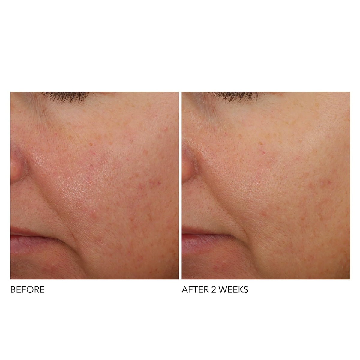 Dr Dennis Gross bottle staged with box in minimalist setting suggesting premium routine
