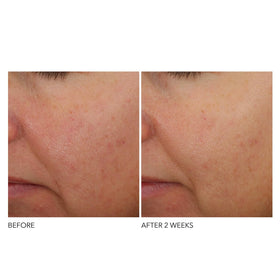 Dr Dennis Gross bottle staged with box in minimalist setting suggesting premium routine