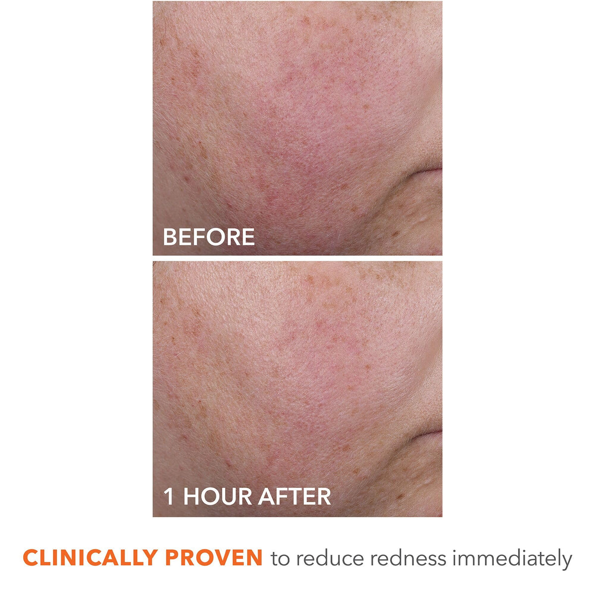 Dr Dennis Gross cream applied on hand, demonstrates smooth application and absorption