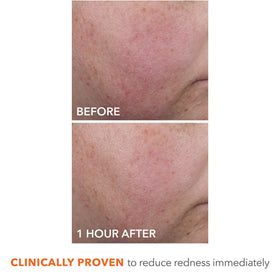 Dr Dennis Gross cream applied on hand, demonstrates smooth application and absorption