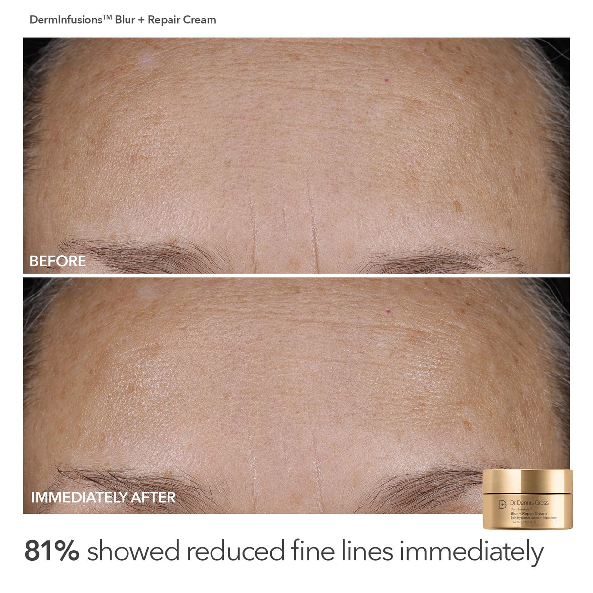 Dr Dennis Gross DermInfusions Blur + Repair Cream jar top view shows cream texture benefit: intense hydration