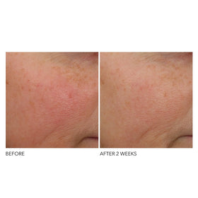 Dr Dennis Gross ingredients label close-up featuring retinol and ferulic acid benefits