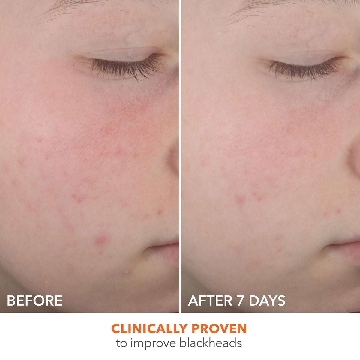 Dr Dennis Gross clear serum texture drop showing lightweight absorption benefit