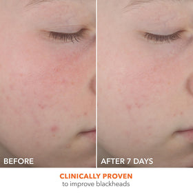 Dr Dennis Gross clear serum texture drop showing lightweight absorption benefit