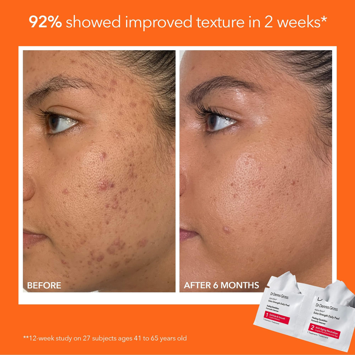 Dr Dennis Gross peel pads texture close-up highlighting exfoliating surface