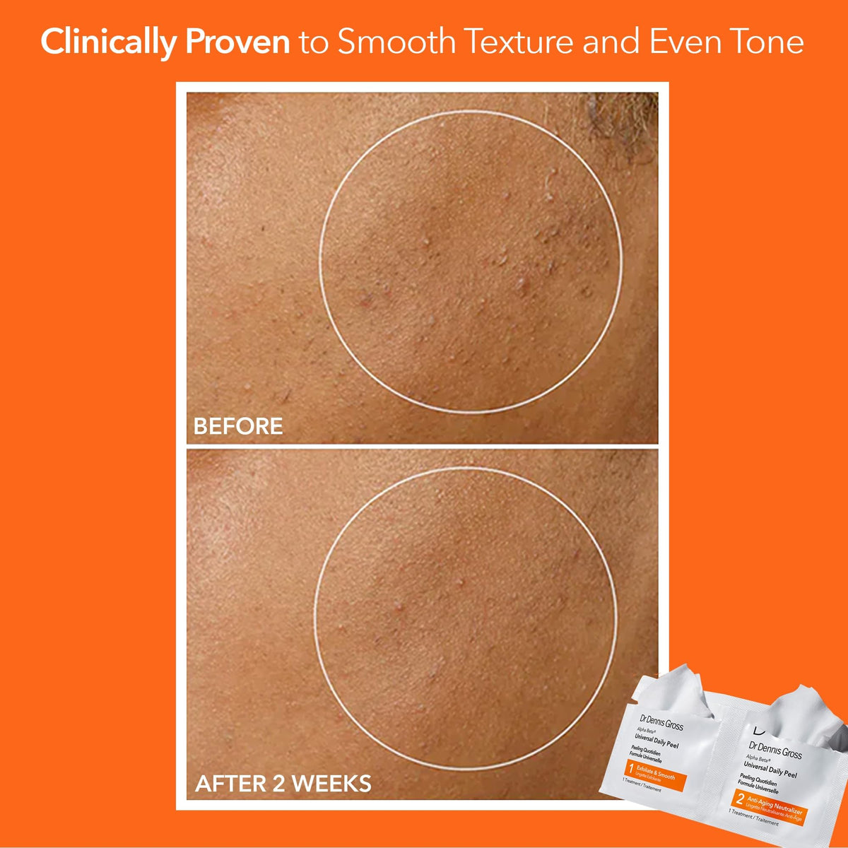 Dr Dennis Gross two-step peel application demonstrating quick professional results