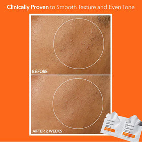 Dr Dennis Gross two-step peel application demonstrating quick professional results