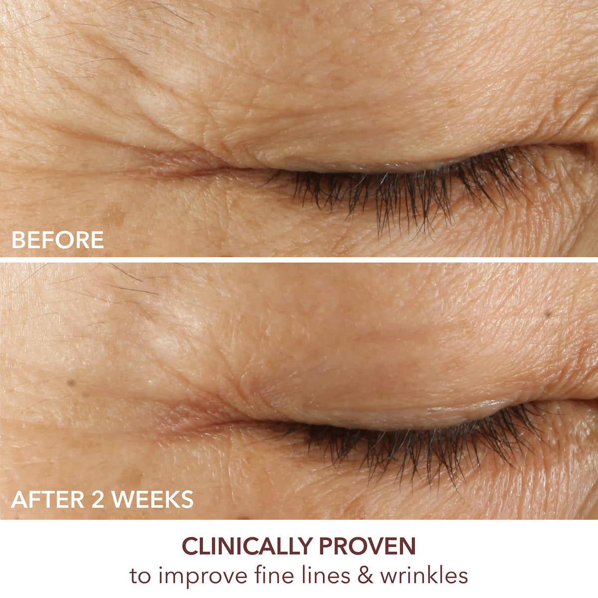 Dr Dennis Gross 15ml size comparison highlighting travel-friendly benefit