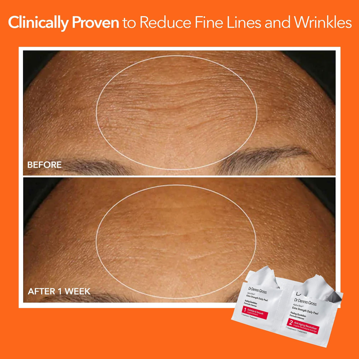 Dr. Dennis Gross box next to a ruler showing 30 treatments scale