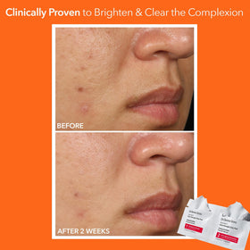 Dr Dennis Gross Step 2 pad soaked in calming serum to soothe and replenish post-exfoliation