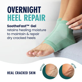Dr. Frederick's open-toe heel socks flat lay showing breathable comfort benefit