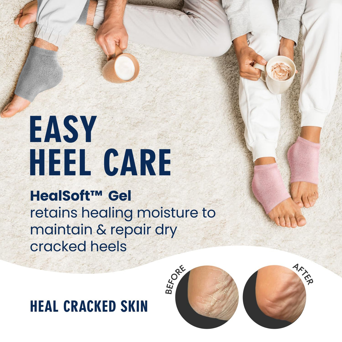 Dr. Frederick's toeless sock design for breathability and comfort