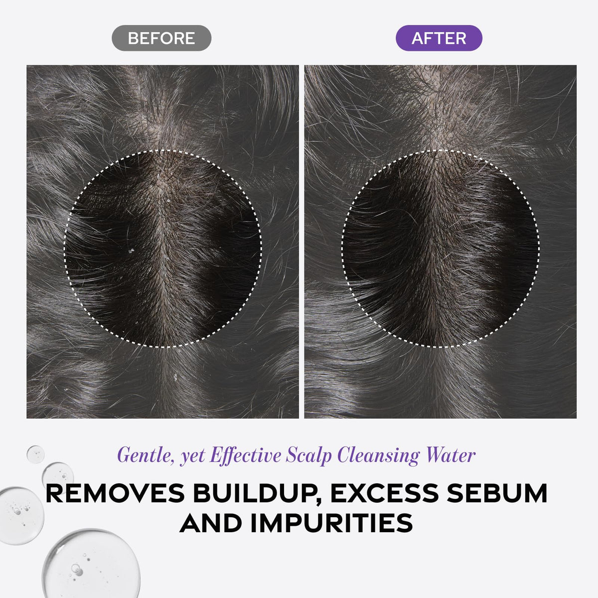 Dr. Groot close-up scalp after use showing cleaner, fresher scalp