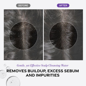 Dr. Groot close-up scalp after use showing cleaner, fresher scalp