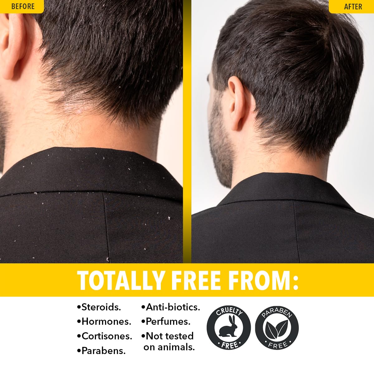Dr. Robaina applied to beard showing gentle hydration and flake reduction