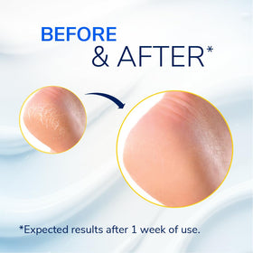 Dr. Scholl's ingredient zoom on urea crystals highlighting concentrated 25% urea for deep hydration
