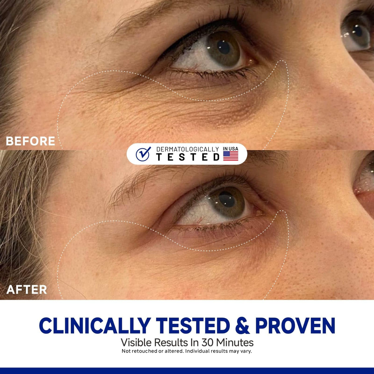 Dr Vincent patch turning transparent showing visible absorption progress