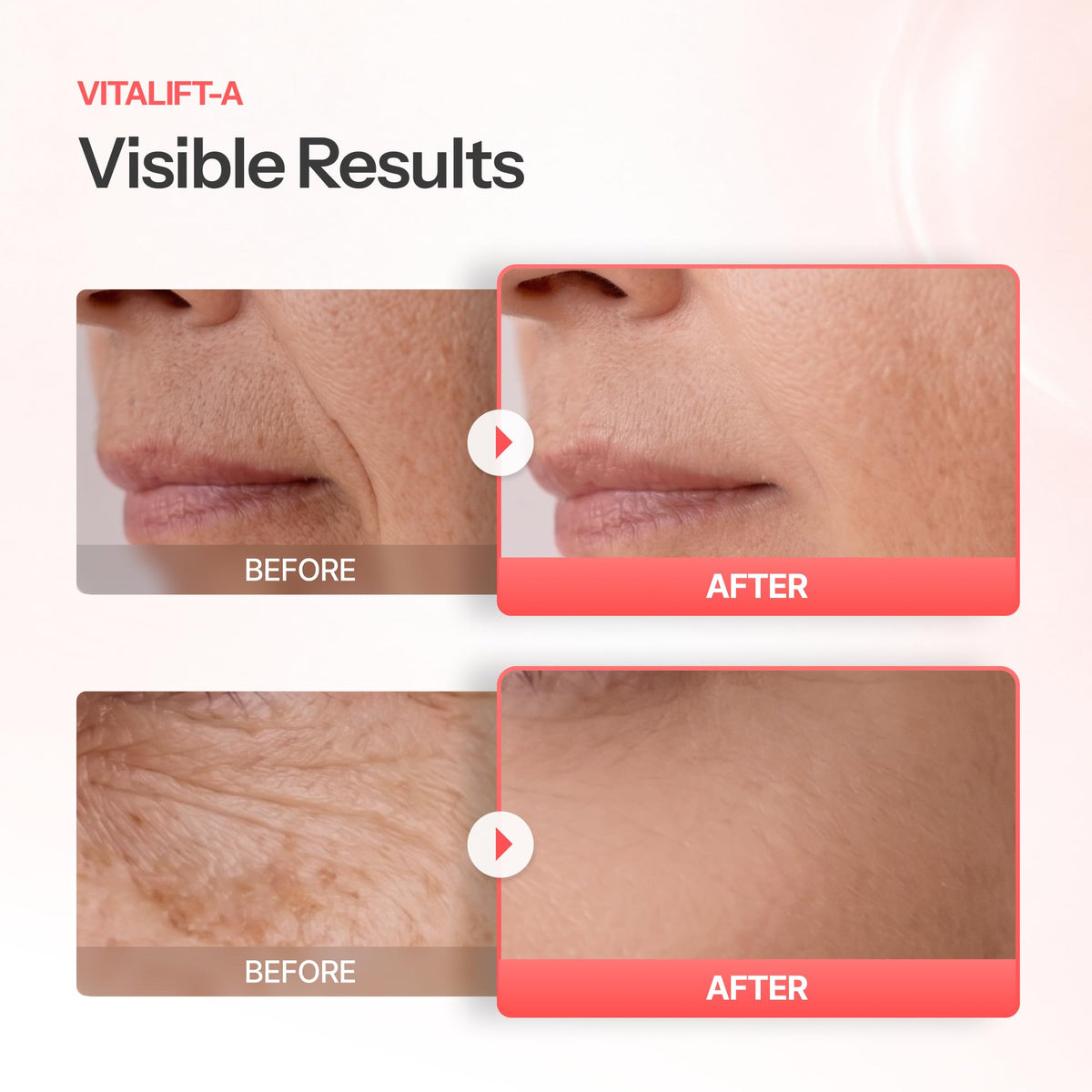Dr.Different cream on fingertip illustrating lightweight texture for easy nightly application