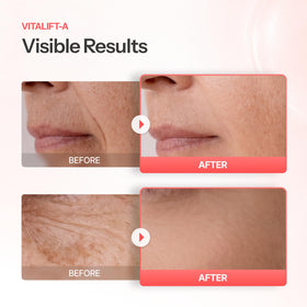 Dr.Different cream on fingertip illustrating lightweight texture for easy nightly application