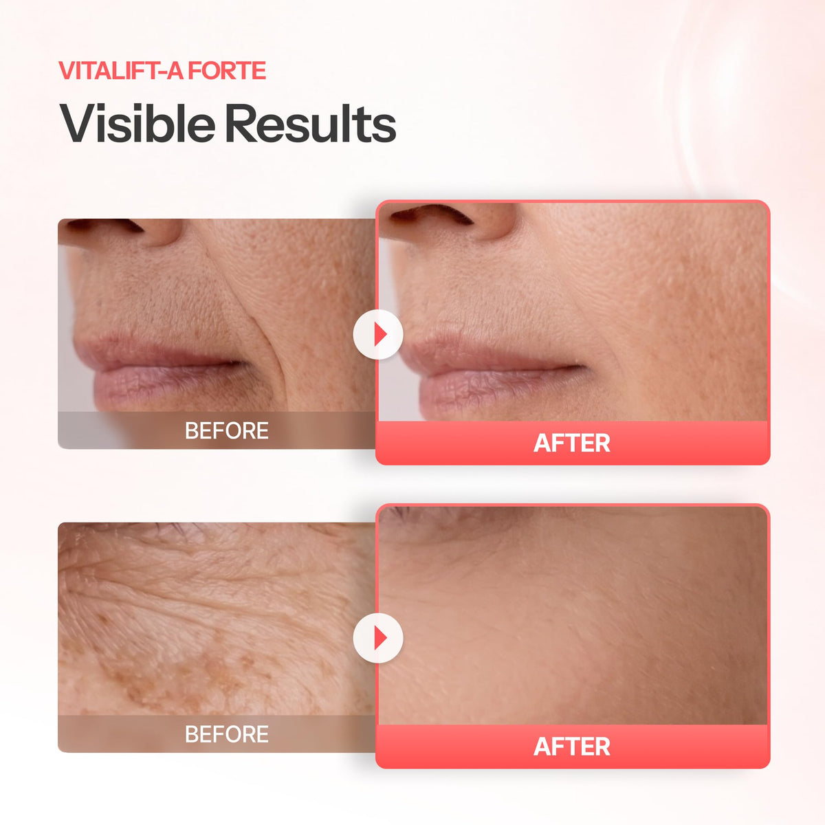 Dr.Different liposome illustration showing stabilized delivery into skin