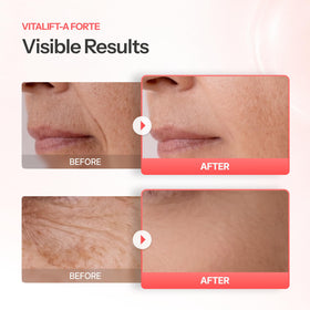 Dr.Different liposome illustration showing stabilized delivery into skin