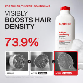 Dr.FORHAIR bottle with rosemary and biotin visualizing natural ingredient support