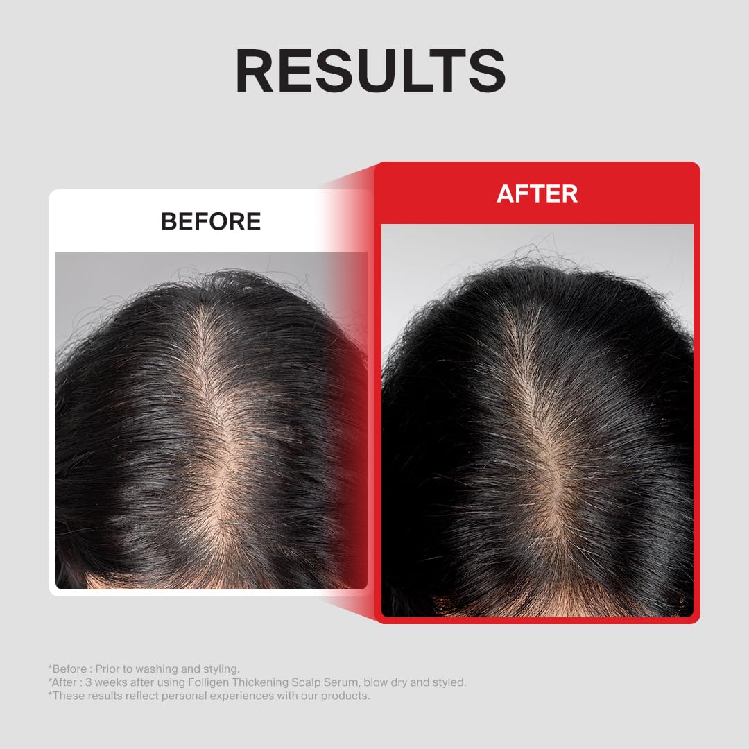 DR.FORHAIR applied to scalp with fingers showing targeted, easy massage benefit