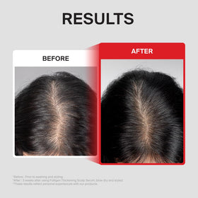 DR.FORHAIR applied to scalp with fingers showing targeted, easy massage benefit