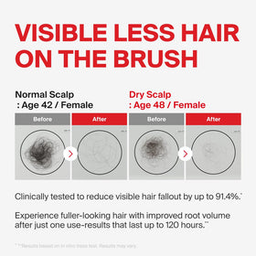 DR.FORHAIR shampoo foam texture on palm demonstrating gentle clarifying action