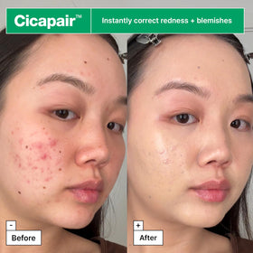 Dr.Jart+ being applied with fingers for quick redness coverage