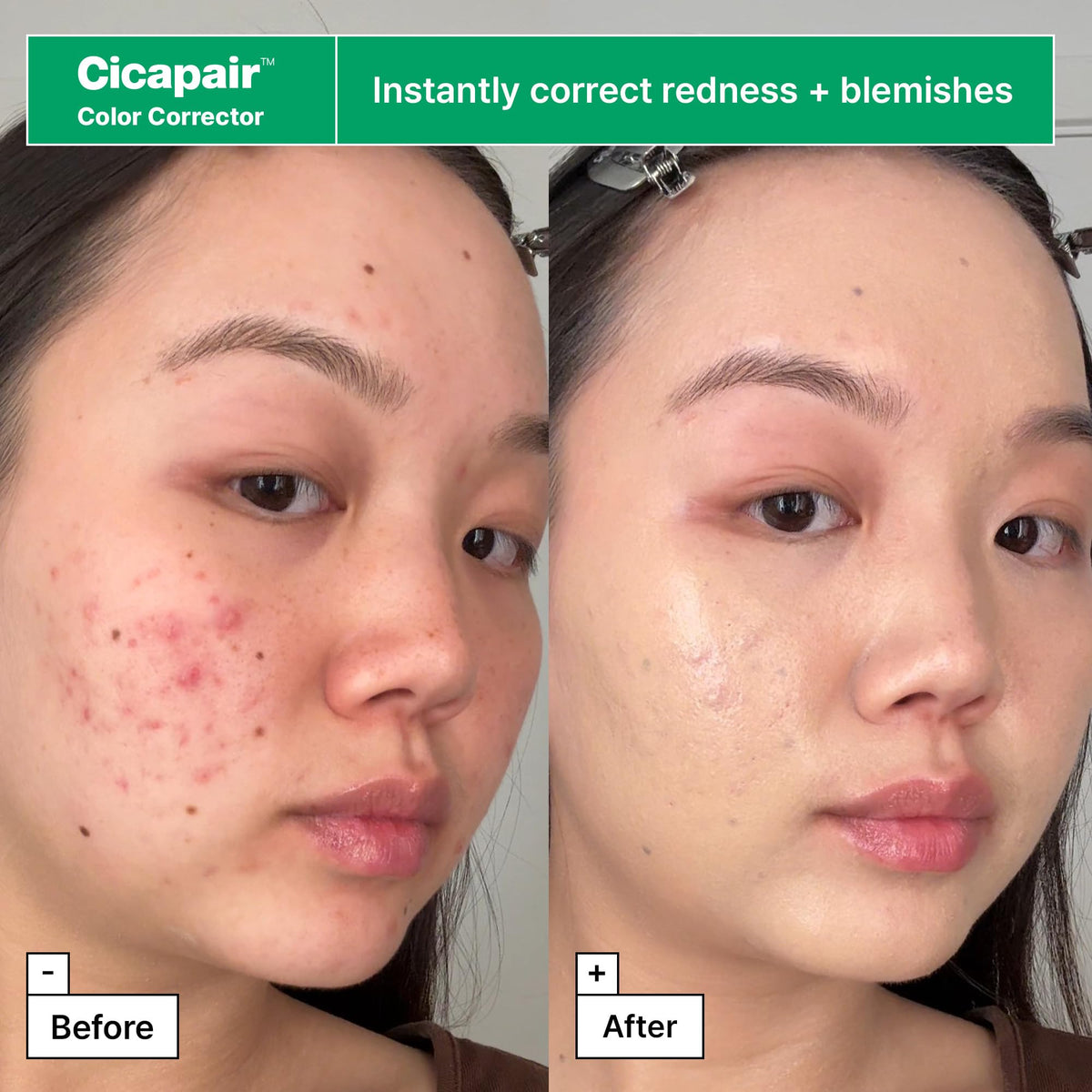 Dr.Jart+ moisturizer jar open showing cream texture and calming finish