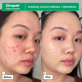 Dr.Jart+ moisturizer jar open showing cream texture and calming finish