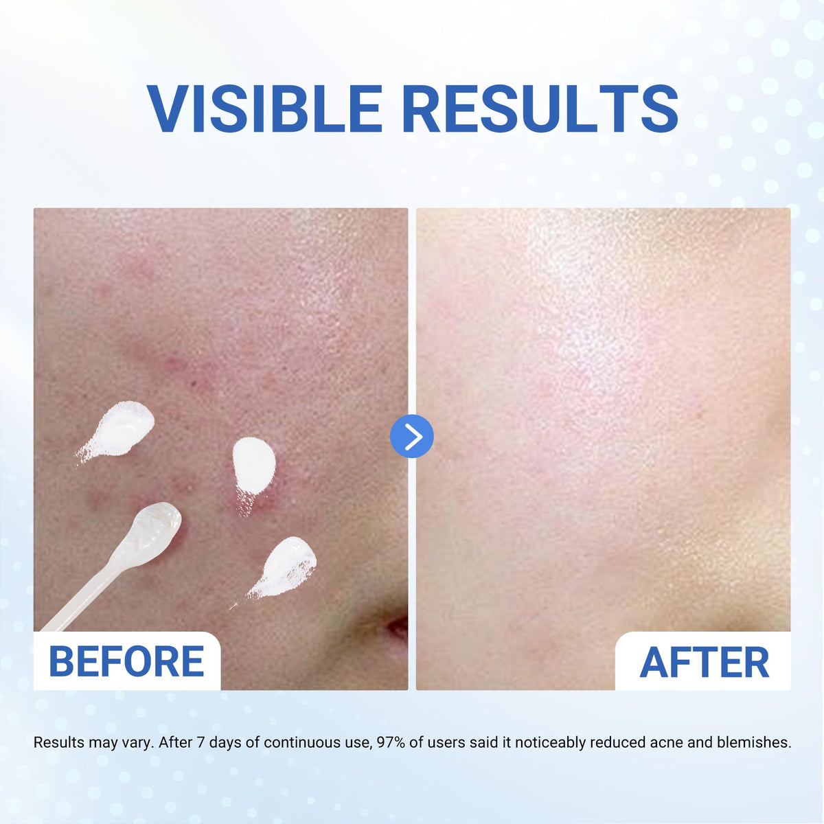 Dr.Leo ingredient label focused on 1.8% salicylic acid benefit: high-strength formula
