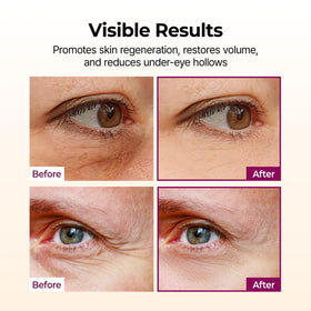 Dr.Melaxin being applied under-eye showing targeted depuffing and smoothing
