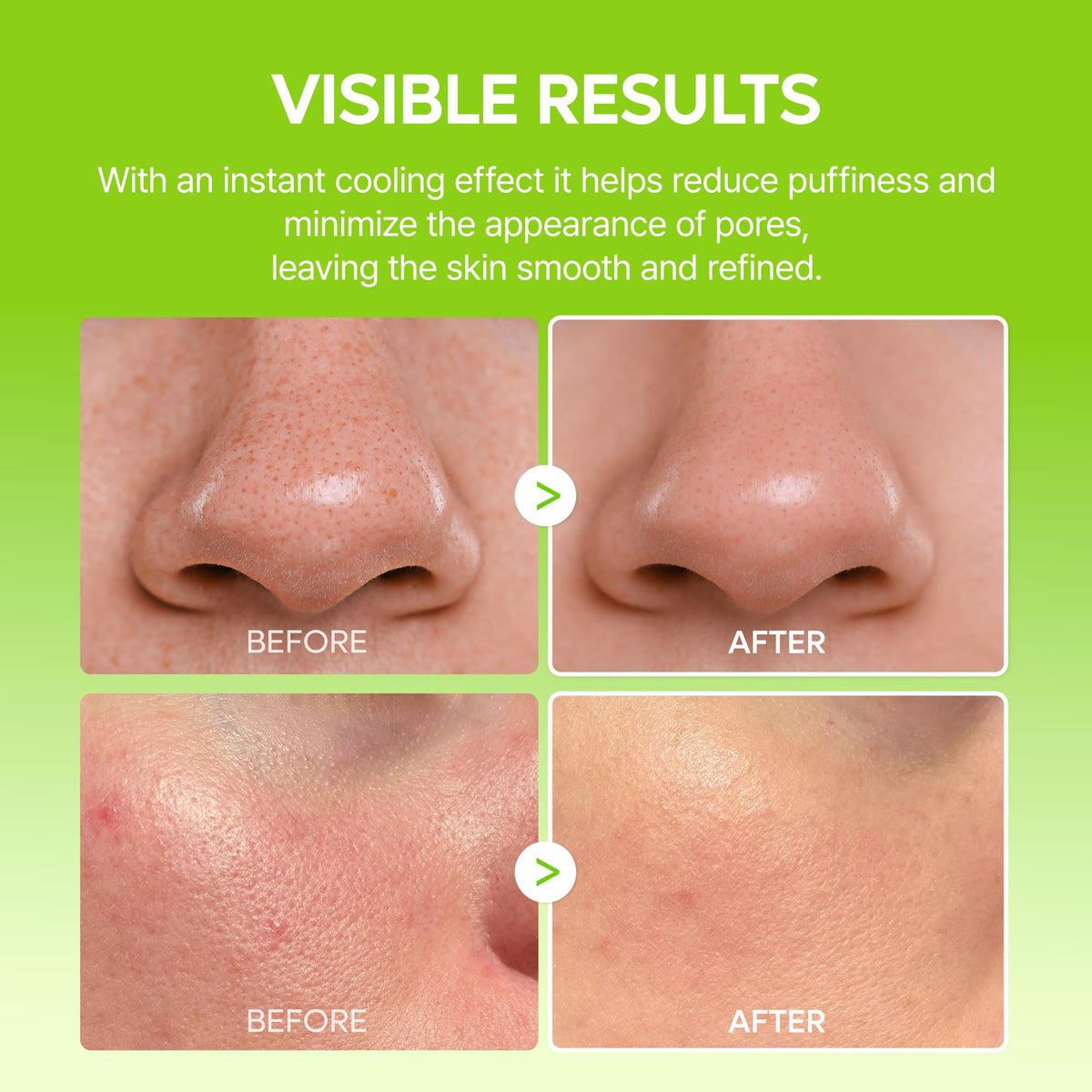 Dr.Melaxin application under-eye showing de-puffing target and cooling benefit