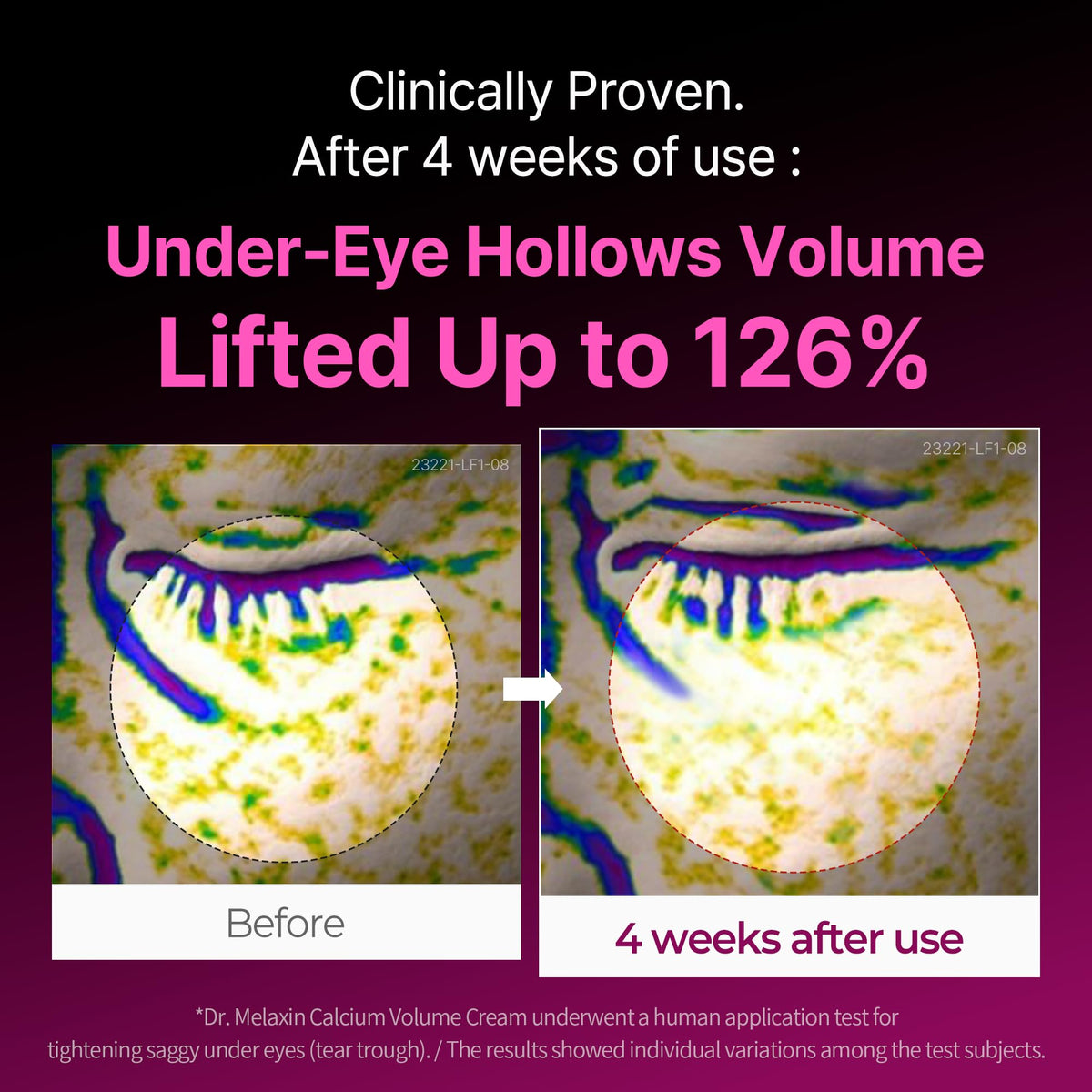 Dr.Melaxin cream texture swirl highlighting rich hydration and spreadability